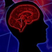 Stroke related image